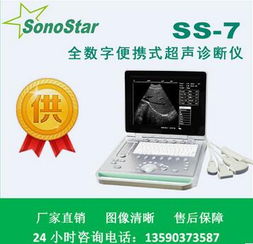 黑白便携超声诊断系统 b超机 超声设备专用厂家图1