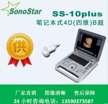 医用四维4D便携式B超机 全数字B型超声诊断仪 B超检查仪 B超价格图1