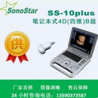 医用四维4D便携式B超机 全数字B型超声诊断仪 B超检查仪 B超价格