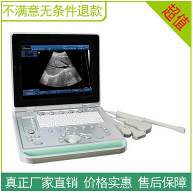 索诺星SS-9妇产科b超机 手提式B超 便携式B超诊断仪 医用b超图1