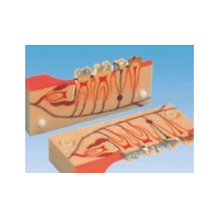 牙分解组织模型
