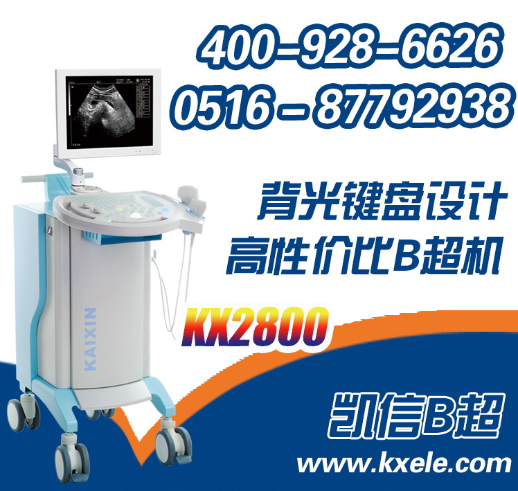 推车式黑白超 台式B超机图1
